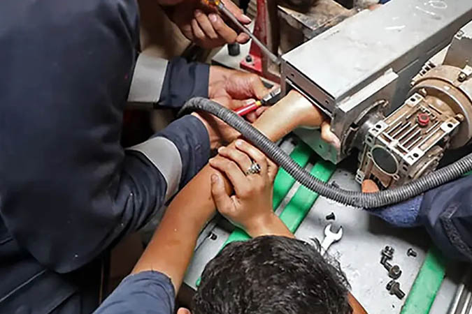 قطع عضو دست کارگر بر اثر گیر کردن در دستگاه صنعتی در کاشان